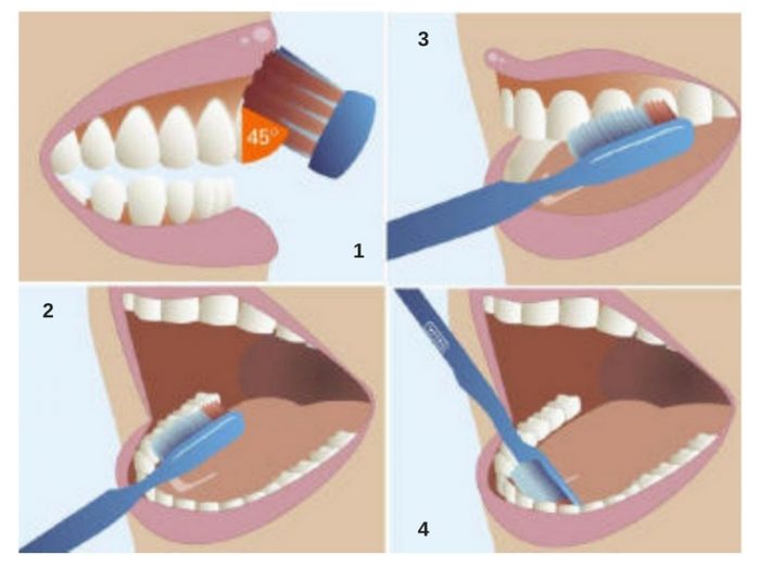 técnica cepillado de dientes