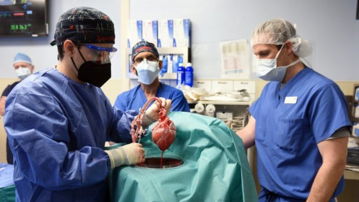 Pig heart transplantation into a human patient