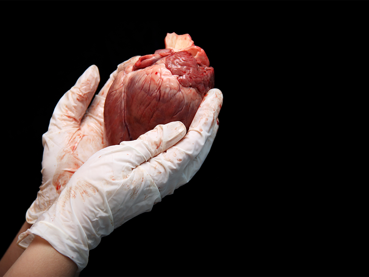 Donación de órganos: 1 vida multiplicada por 8